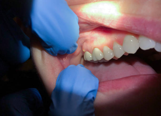 Best Broken Tooth Emergency  in Crockett, TX